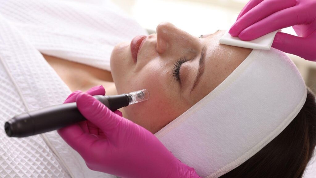 Lux Injectables Expands Microneedling Program After Demand Surge